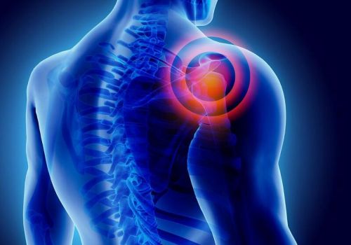 3 bệnh khớp vai thường gặp ở người cao tuổi