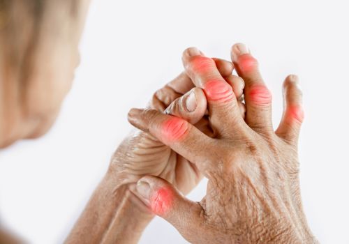 Phòng thấp gây đau nhức xương khớp như thế nào?