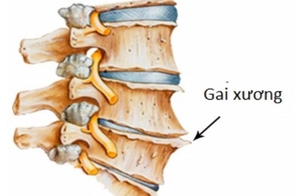 gai cot song1