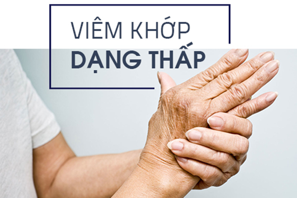 phuong-phap-chua-benh-viem-da-khop-dang-thap-1